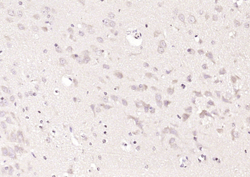 Ornithine aminotransferase Rabbit Polyclonal Antibody