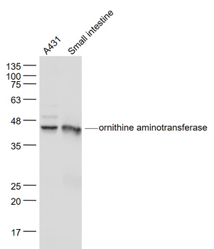 Ornithine aminotransferase Rabbit Polyclonal Antibody
