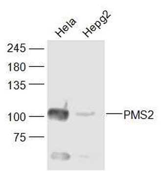 PMS2 Rabbit Polyclonal Antibody