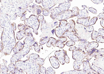 Placental lactogen Rabbit Polyclonal Antibody