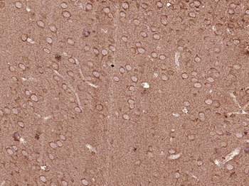 PI3 Kinase p110 beta Rabbit Polyclonal Antibody