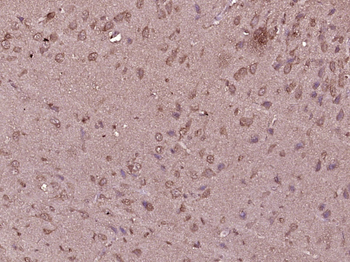 PI3 Kinase p110 beta Rabbit Polyclonal Antibody