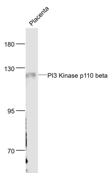 PI3 Kinase p110 beta Rabbit Polyclonal Antibody