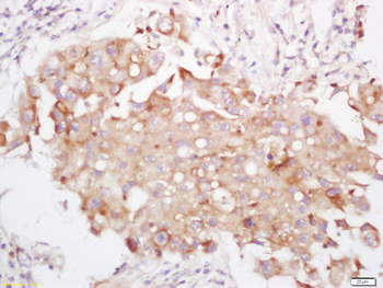 PI3 Kinase p110 delta Rabbit Polyclonal Antibody