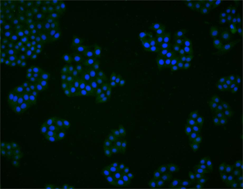 Phosphor-PPP3CA (Ser469) Rabbit Polyclonal Antibody