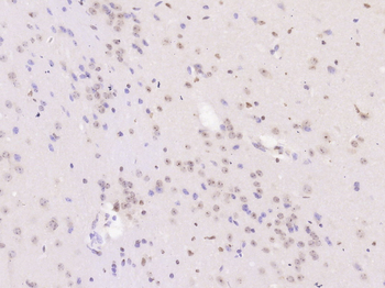 Phosphor-PPP3CA (Ser469) Rabbit Polyclonal Antibody