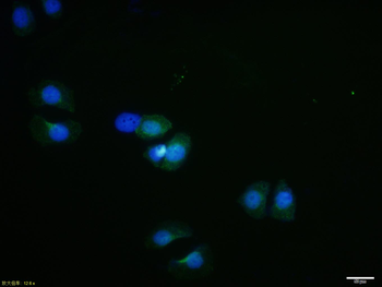 RPS6KA1 Rabbit Polyclonal Antibody