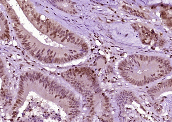 RPS6KA1 Rabbit Polyclonal Antibody