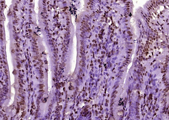 RPS6KA1 Rabbit Polyclonal Antibody