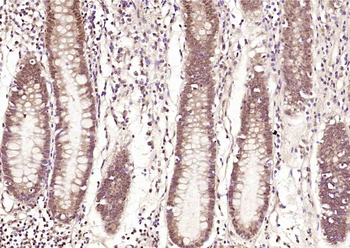PER-3 Rabbit Polyclonal Antibody
