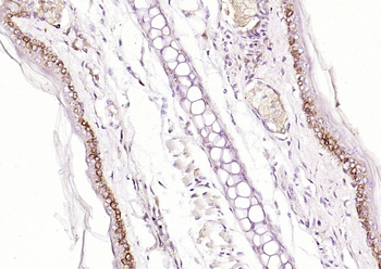 P21-ARC Rabbit Polyclonal Antibody