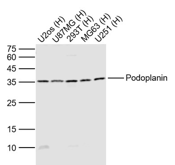 Podoplanin Rabbit Polyclonal Antibody