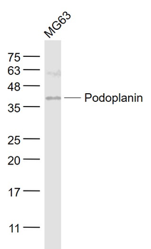 Podoplanin Rabbit Polyclonal Antibody