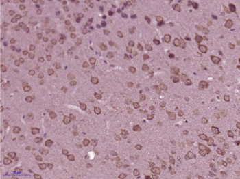 PLEKHG5 Rabbit Polyclonal Antibody