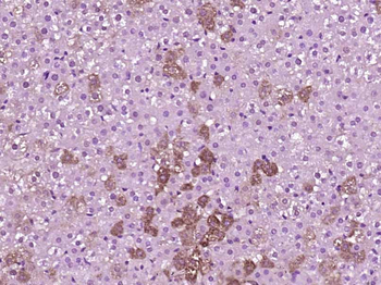 PLEKHG5 Rabbit Polyclonal Antibody