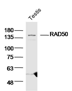 RAD50 Rabbit Polyclonal Antibody