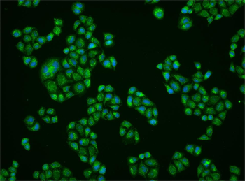 PHB2 Rabbit Polyclonal Antibody