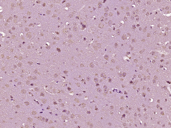 RET Rabbit Polyclonal Antibody