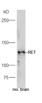 RET Rabbit Polyclonal Antibody