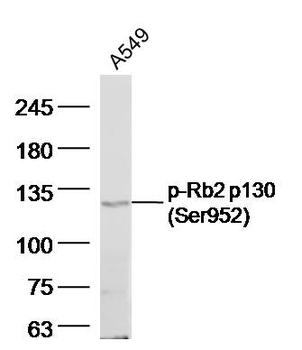 Phospho-Rb2 p130 (Ser952) Rabbit Polyclonal Antibody