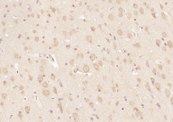 RRAGA + RRAGB Rabbit Polyclonal Antibody