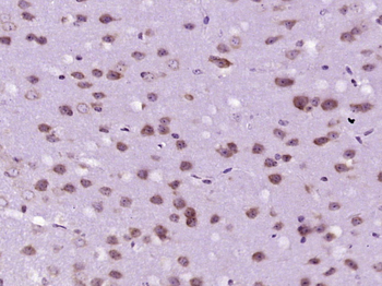 RPS7 Rabbit Polyclonal Antibody