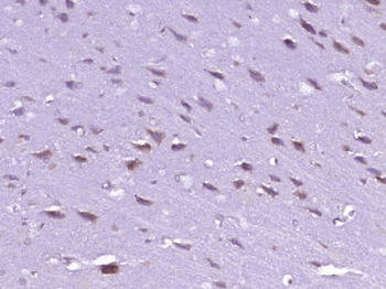 RPS7 Rabbit Polyclonal Antibody