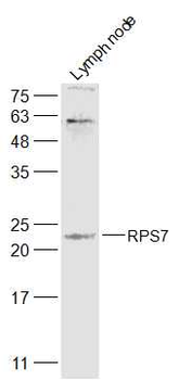 RPS7 Rabbit Polyclonal Antibody