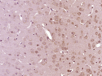 RPS8 Rabbit Polyclonal Antibody