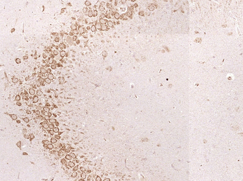 RPS9 Rabbit Polyclonal Antibody