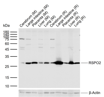 RSPO2 Rabbit Polyclonal Antibody