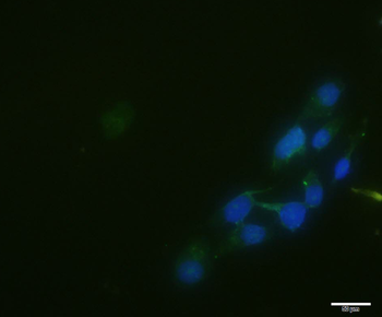 SRC Rabbit Polyclonal Antibody