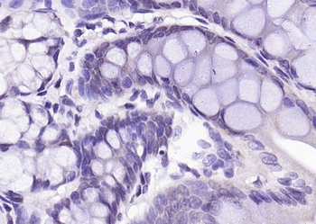 SRC Rabbit Polyclonal Antibody