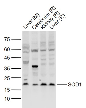 SOD1 Rabbit Polyclonal Antibody