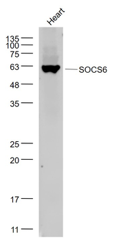 SOCS6 Rabbit Polyclonal Antibody