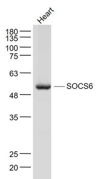 SOCS6 Rabbit Polyclonal Antibody