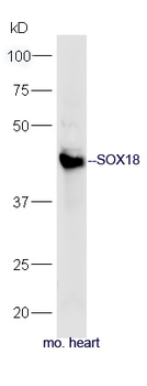 SOX18 Rabbit Polyclonal Antibody