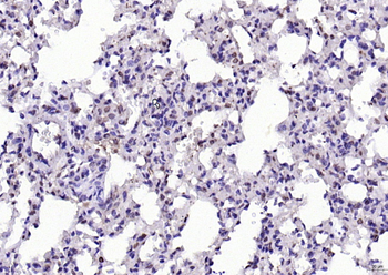 SBNO1 Rabbit Polyclonal Antibody