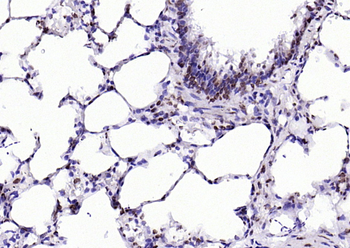 SBNO1 Rabbit Polyclonal Antibody