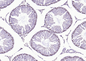 SBNO1 Rabbit Polyclonal Antibody