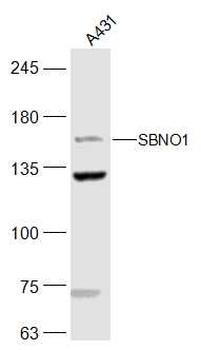 SBNO1 Rabbit Polyclonal Antibody