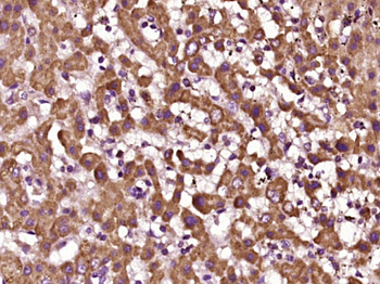 SC11A Rabbit Polyclonal Antibody