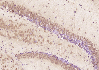 SAFB Rabbit Polyclonal Antibody