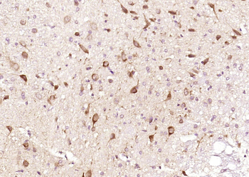 SAFB Rabbit Polyclonal Antibody