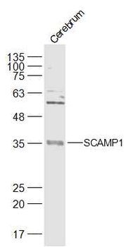 SCAMP1 Rabbit Polyclonal Antibody