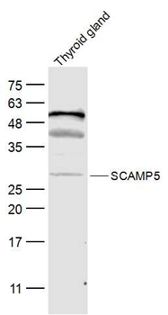 SCAMP5 Rabbit Polyclonal Antibody