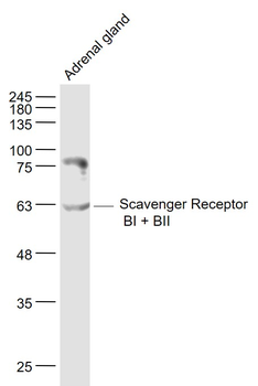 Scavenger Receptor BI + BII Rabbit Polyclonal Antibody