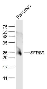 SFRS9 Rabbit Polyclonal Antibody