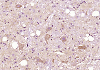 SFXN3 Rabbit Polyclonal Antibody