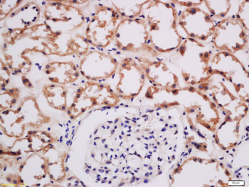 SFXN3 Rabbit Polyclonal Antibody